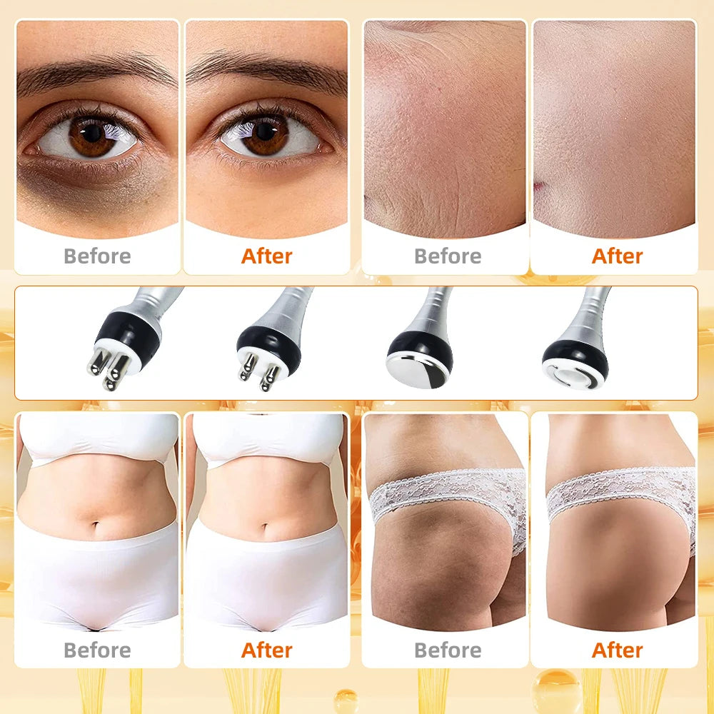 Moonic Beauty 4-In-1 Ultrasonic Slimming And Lifting Machine