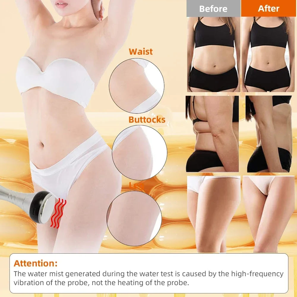 Missheart Ultrasonic Cavitation Body Slimming Machine Beauty Device Massager