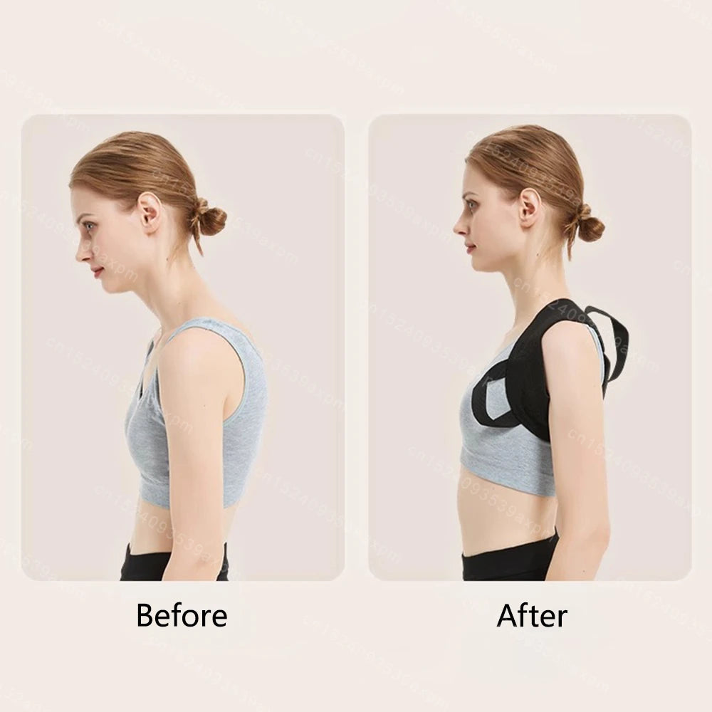 Zoechic Back Posture Corrector Belt Adjustable Unisex Support